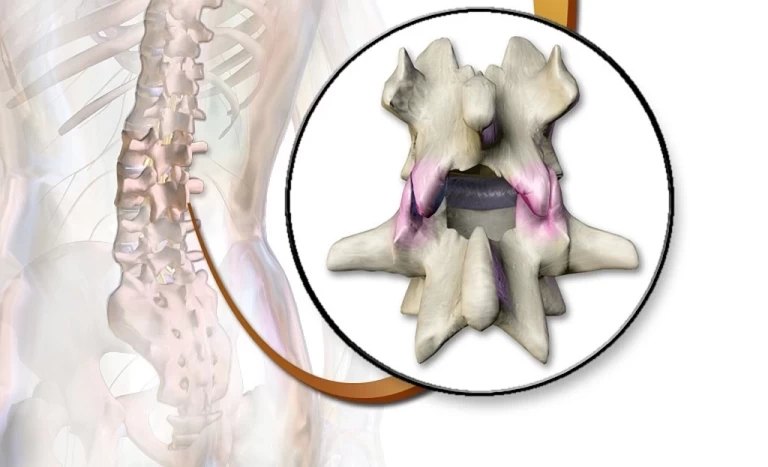 Chiropractors Explain the Importance of Caring for Facet Joints
